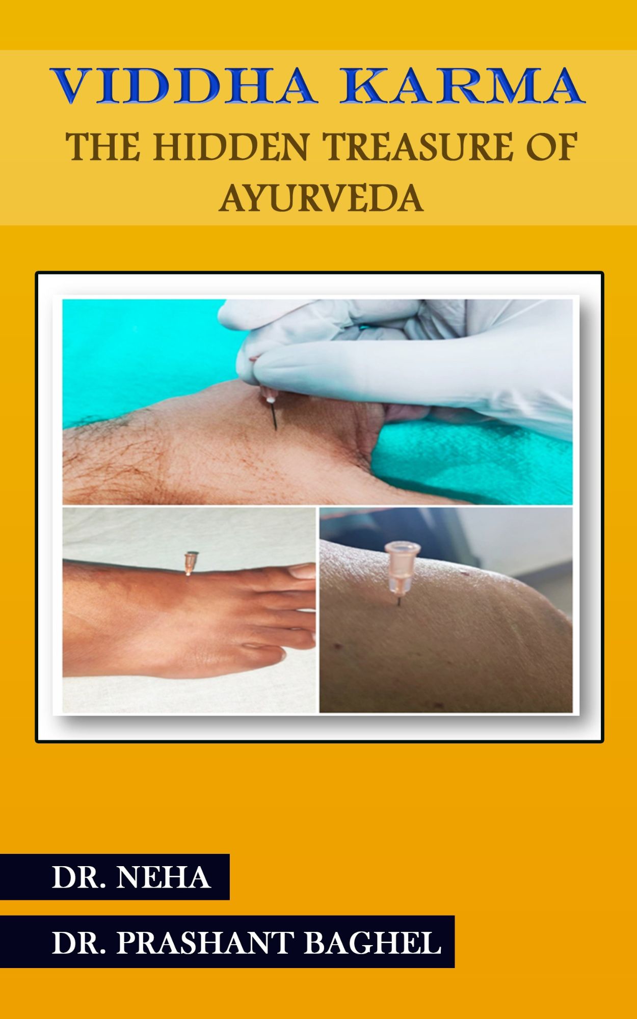 Techip Infotech Pvt Ltd